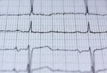 digital fusion beam technology